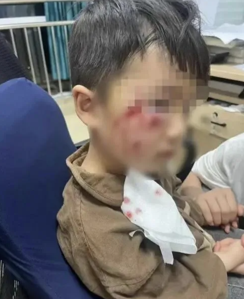 被瘋?cè)麤](méi)有“救命藥”，怎么辦？